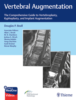 Hardcover Vertebral Augmentation: The Comprehensive Guide to Vertebroplasty, Kyphoplasty, and Implant Augmentation Book