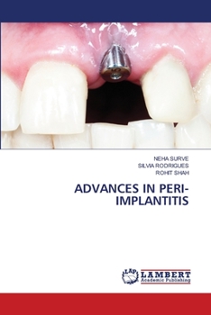 Paperback Advances in Peri-Implantitis Book