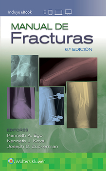 Paperback Manual de Fracturas [Spanish] Book