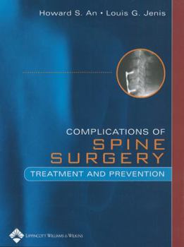 Hardcover Complications of Spine Surgery: Treatment and Prevention Book