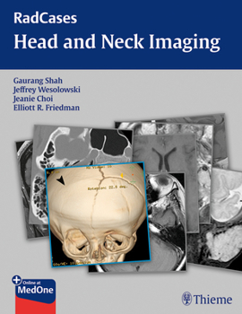 Paperback Radcases Head and Neck Imaging Book