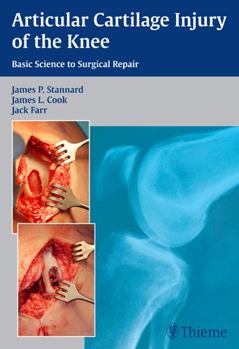 Hardcover Articular Cartilage Injury of the Knee: Basic Science to Surgical Repair Book