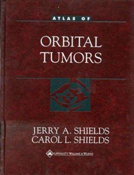 Hardcover Atlas of Orbital Tumors Book