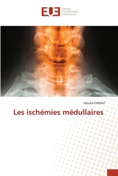 Les ischémies médullaires (French Edition)