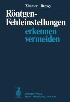 Paperback Röntgen-Fehleinstellungen: Erkennen Und Vermeiden [German] Book