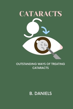 Paperback Cataracts: Outstanding Ways of Treating Cataracts Book