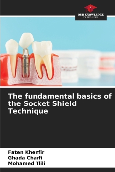 Paperback The fundamental basics of the Socket Shield Technique Book