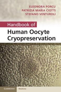Hardcover Handbook of Human Oocyte Cryopreservation Book