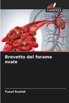 Paperback Brevetto del forame ovale [Italian] Book