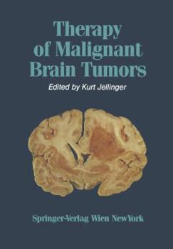 Paperback Therapy of Malignant Brain Tumors Book