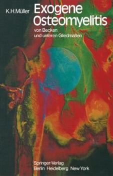 Paperback Exogene Osteomyelitis Von Becken Und Unteren Gliedmaßen: Besonderheiten Pathogenese Klinik Therapie Ergebnisse [German] Book
