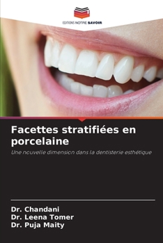 Paperback Facettes stratifiées en porcelaine [French] Book