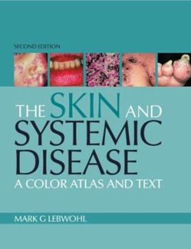 Hardcover The Skin and Systemic Disease: A Color Atlas and Text Book