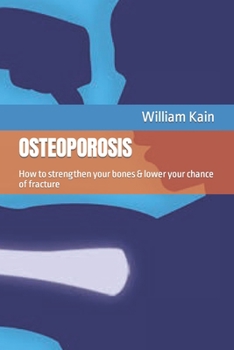 Paperback Osteoporosis: How to strengthen your bones & lower your chance of fracture Book
