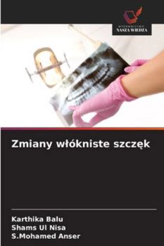 Paperback Zmiany wlókniste szcz&#281;k [Polish] Book