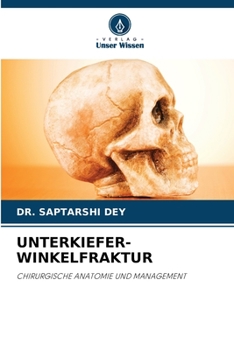 Paperback Unterkiefer-Winkelfraktur [German] Book