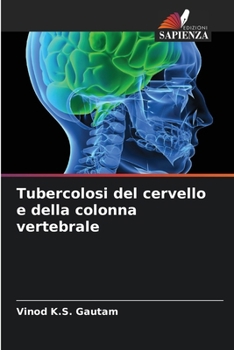 Tubercolosi del cervello e della colonna vertebrale (Italian Edition)