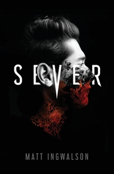 Paperback Sever Book