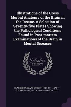 Paperback Illustrations of the Gross Morbid Anatomy of the Brain in the Insane. A Selection of Seventy-five Plates Showing the Pathological Conditions Found in Book