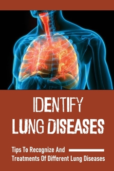 Paperback Identify Lung Diseases: Tips To Recognize And Treatments Of Different Lung Diseases: Chest X-Ray Symptoms Book