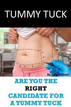 Paperback Tummy Tuck: Are You The Right Candidate For A Tummy Tuck Book