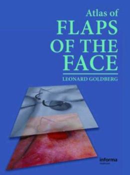 Hardcover Atlas of Flaps of the Face Book