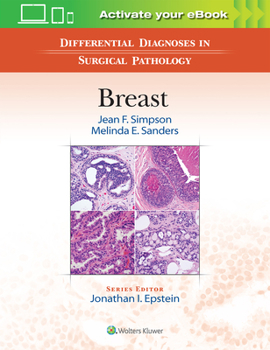 Hardcover Differential Diagnoses in Surgical Pathology: Breast Book