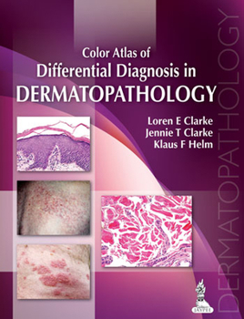 Hardcover Color Atlas of Differential Diagnosis in Dermatopathology Book