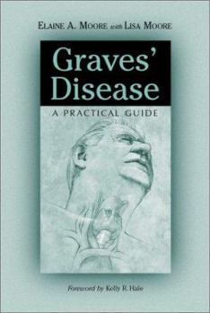 Paperback Graves' Disease: A Practical Guide Book