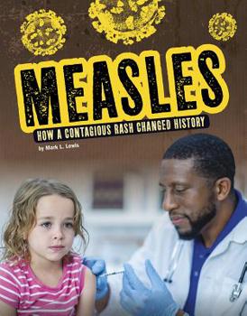 Hardcover Measles: How a Contagious Rash Changed History Book