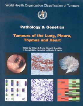 Paperback Pathology and Genetics of Tumours of the Lung, Pleura, Thymus and Heart [Op] Book