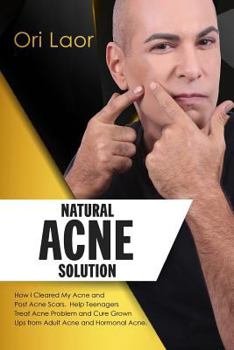 Paperback Natural Acne Solution: How I Cleared My Acne and Post Acne Scars. Help Teenagers Treat Acne Problem and Cure Grown Ups from Adult Acne and Ho Book