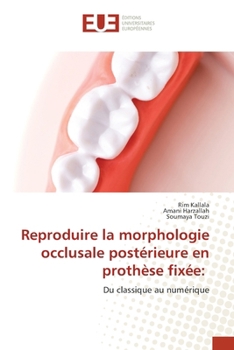Paperback Reproduire la morphologie occlusale postérieure en prothèse fixée [French] Book