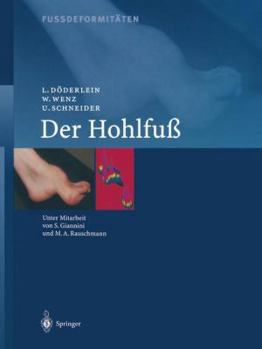 Paperback Fussdeformitäten: Der Hohlfuss [German] Book