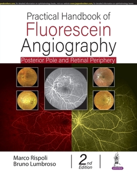 Paperback Practical Handbook of Fluorescein Angiography: Posterior Pole and Retinal Periphery Book