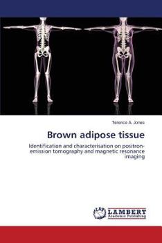 Brown adipose tissue: Identification and characterisation on positron-emission tomography and magnetic resonance imaging