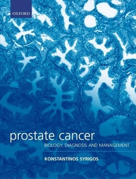 Hardcover Prostate Cancer: Biology, Diagnosis and Management Book