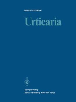 Paperback Urticaria Book