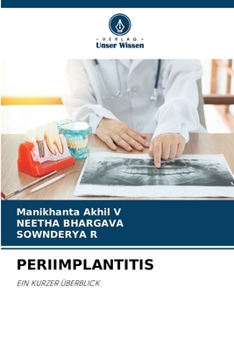 Paperback Periimplantitis [German] Book