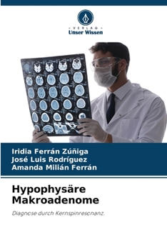 Paperback Hypophysäre Makroadenome [German] Book