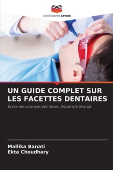 Un Guide Complet Sur Les Facettes Dentaires (French Edition)