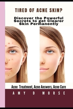Paperback TIRED OF ACNE SKIN? Discover the Powerful Secrets to get clearer skin Permanently Book