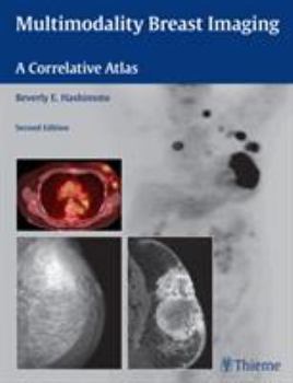 Hardcover Multimodality Breast Imaging: A Correlative Atlas Book