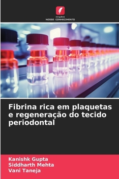 Paperback Fibrina rica em plaquetas e regeneração do tecido periodontal (Portuguese Edition) [Portuguese] Book