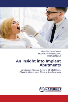 An Insight into Implant Abutments