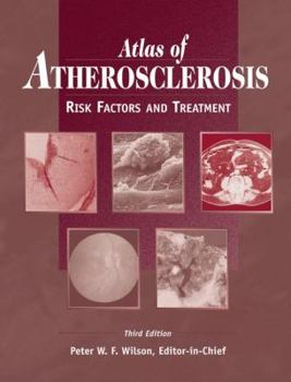 Hardcover Atlas of Atherosclerosis: Risk Factors and Treatment Book