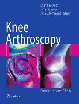 Paperback Knee Arthroscopy Book