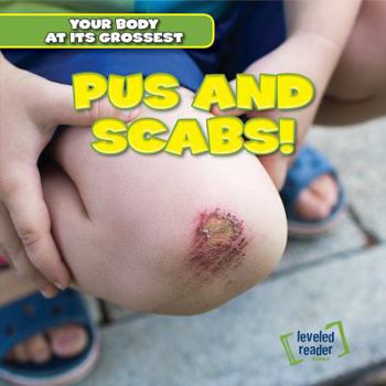 Pus and Scabs! - Book  of the Your Body at Its Grossest