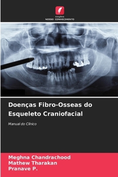 Paperback Doenças Fibro-Osseas do Esqueleto Craniofacial [Portuguese] Book