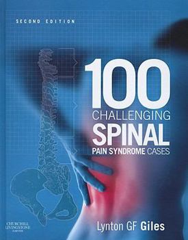 Hardcover 100 Challenging Spinal Pain Syndrome Cases Book